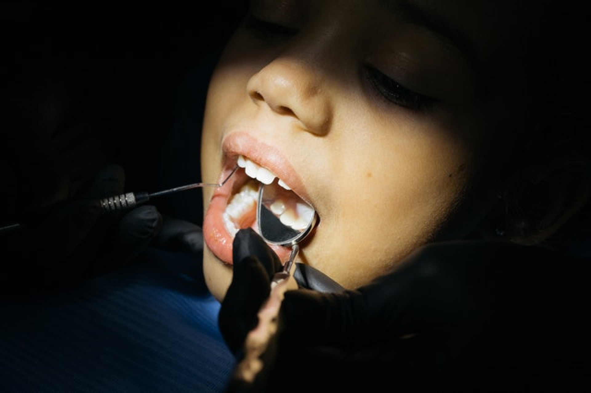 Nie sabotuj swojego leczenia ortodontycznego colą